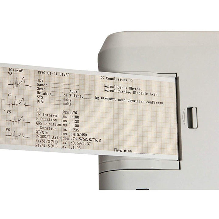 Electrocardiógrafo portátil Mobiclinic ECG90A 3 canales a bateria